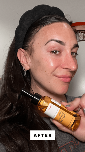 Wohlner after applying the Manyo Pure Cleansing Oil